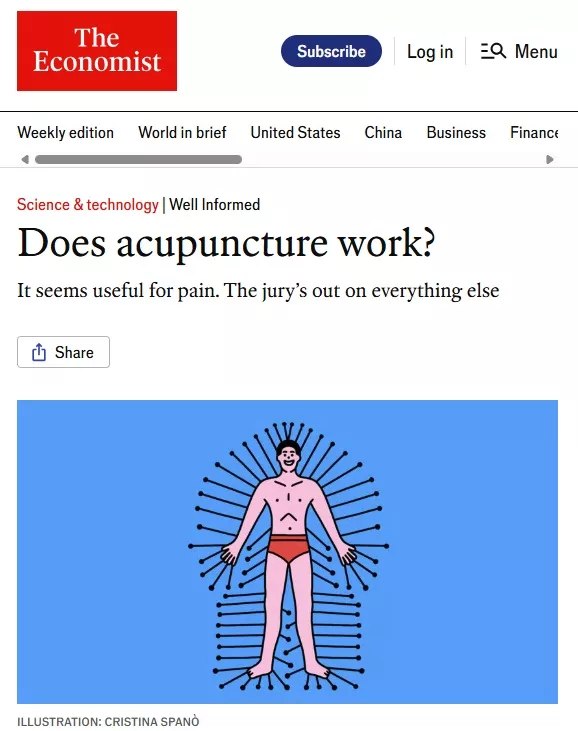 经济学人：针灸为什么有用？