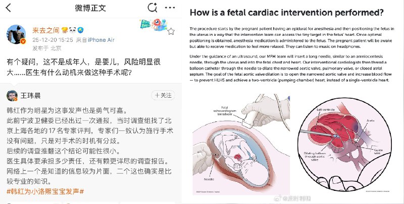 【专家解读小洛熙手术争议】专家解读