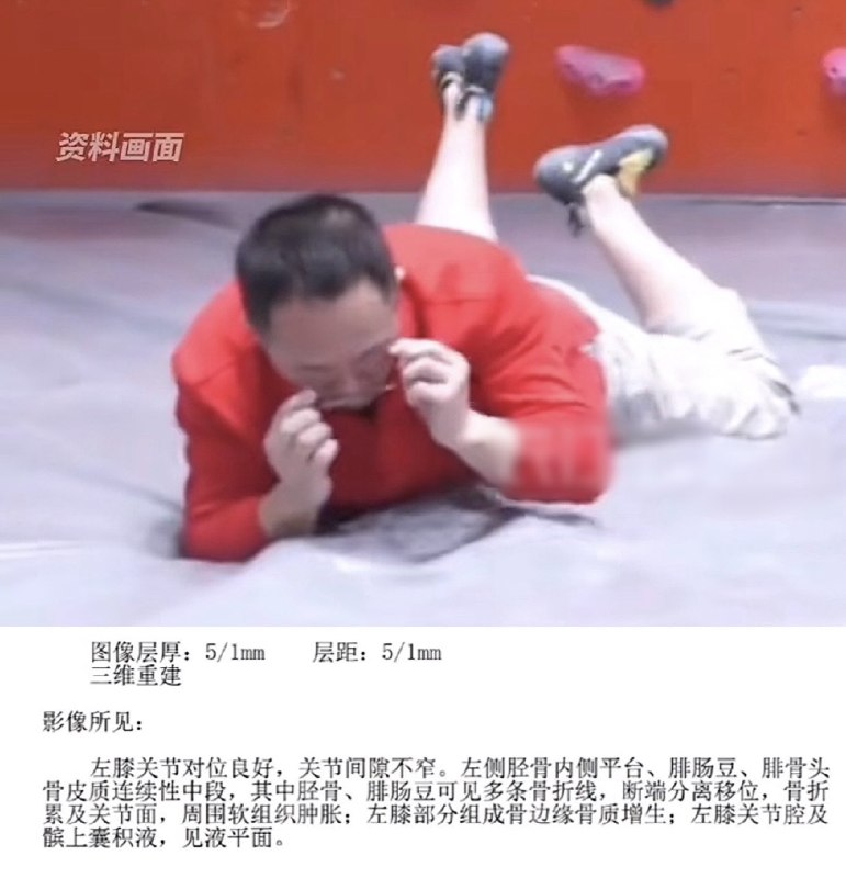 1.360老板周鸿祎说，自己攀岩时脱手，从三米高处摔下来，左腿骨折，三个月内的外出活动全取消了