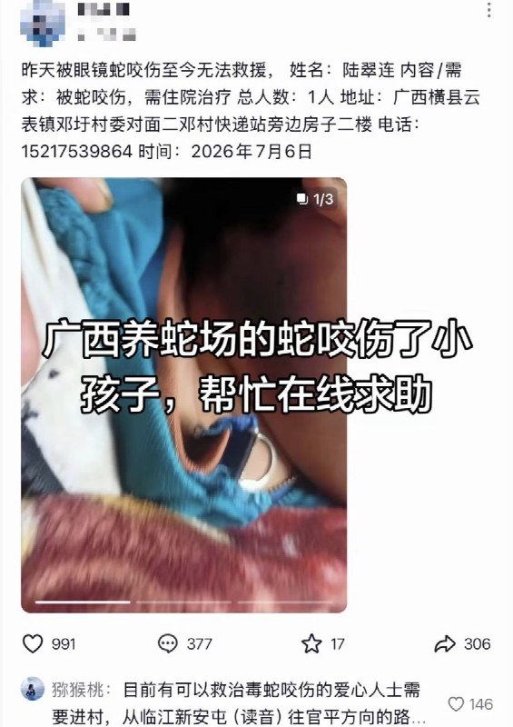 1.7月7日，横州市云表镇，一小孩被出逃的眼镜蛇咬伤后，因抢救不及时而去世1.7月7日，横州市云表镇，一小孩被出逃的眼镜蛇咬伤后，因抢救不及时而去世