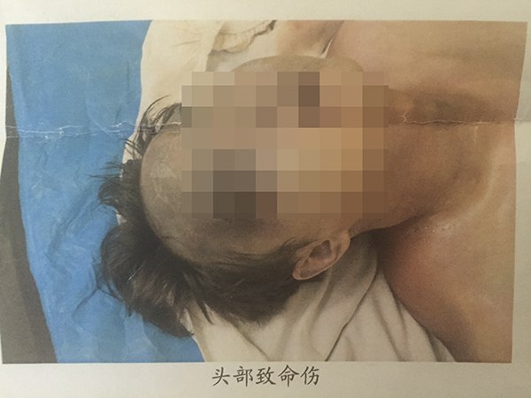 1.【贵州28岁公务员被送去戒酒，两天后死在无资质特训学校】段林吟，1987年出生，贵州凯里市某局工作人员，大学毕业后于2009年参加工作