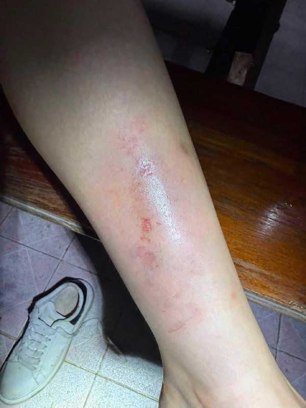 1.【中国女子在泰国遭4人绑架，途中跳车逃生】8月23日，一名中国女子在泰国曼谷误上“导游”车辆，随后遭4名泰国男子绑架，疑似准备被送往湄索