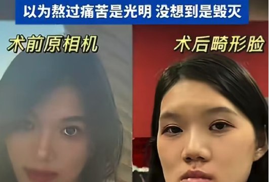 武汉24岁女做正颌手术 医生反向操作致多重损伤