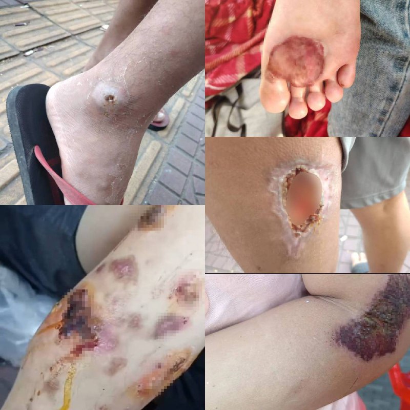 #柬埔寨电诈园区大逃亡亲历