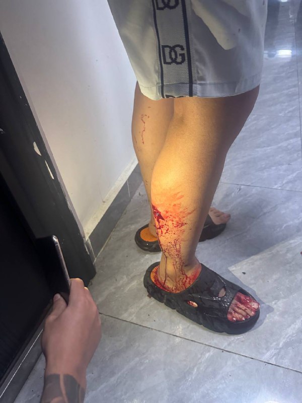 1. 中枪的好多！请求中国🇨🇳救救我们所有困在顺达园区被压榨的中国人2. 顺达园区特大新闻 好多人中枪了3. 顺达冲园区失败过程 外面机关枪一直在射啊，他妈的跟打仗一样！4. 顺达园区开枪扫倒好多人了完蛋了 现在统计超过20个中枪的人了腹部中枪还有头部很多人已经奄奄一息了5. 顺达放火烧宿舍冲园区 现在宿舍火很大整栋烧完了最新进展见焦点群